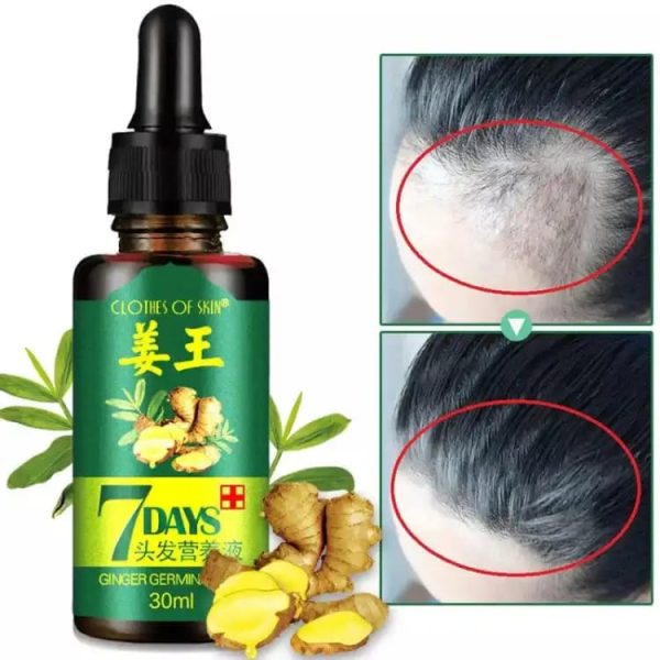 7-days-hair-growth-germinal-serum-oil-30ml